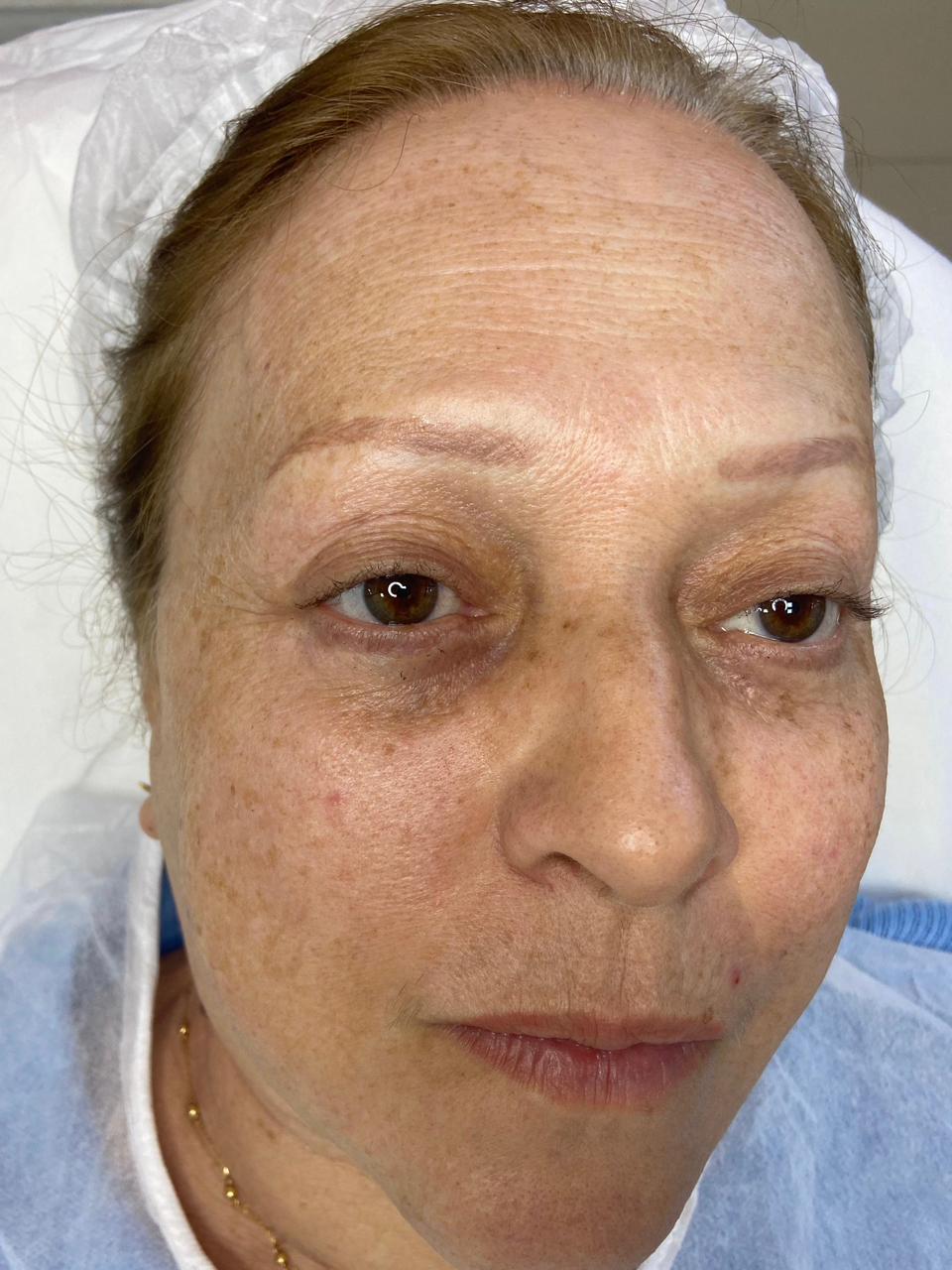 Sobrancelhas — Fio a Fio - antes e depois