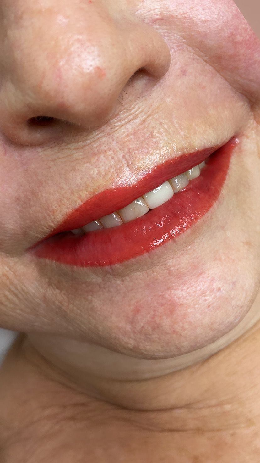 Lábios — Full Lips - antes e depois