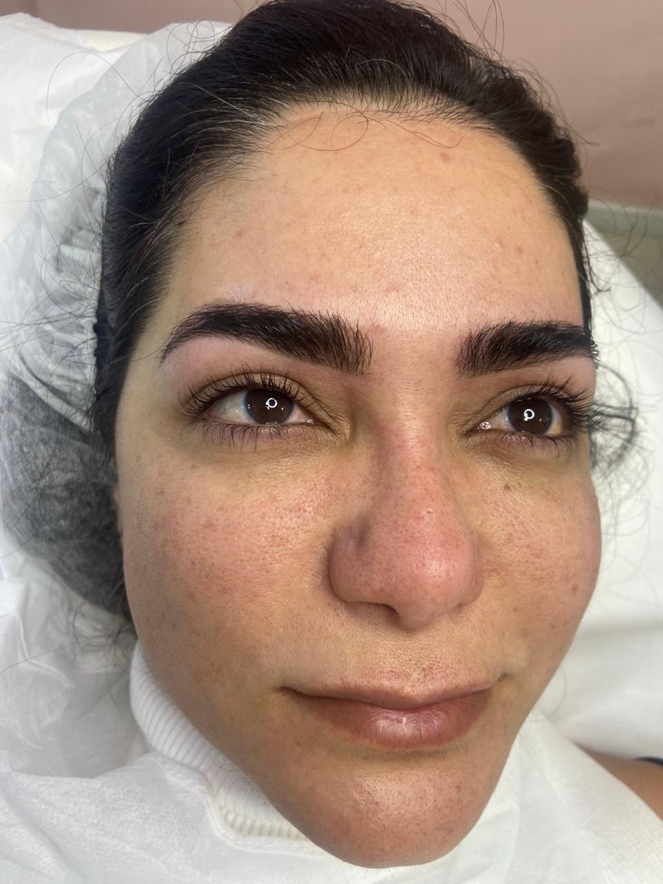 Sobrancelhas — Efeito Glow - antes e depois