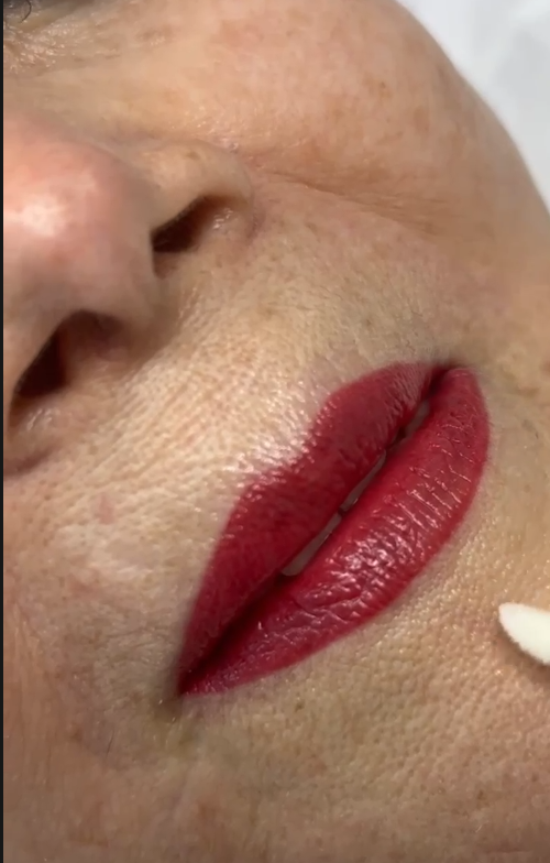 Lábios — Soft Lips - antes e depois