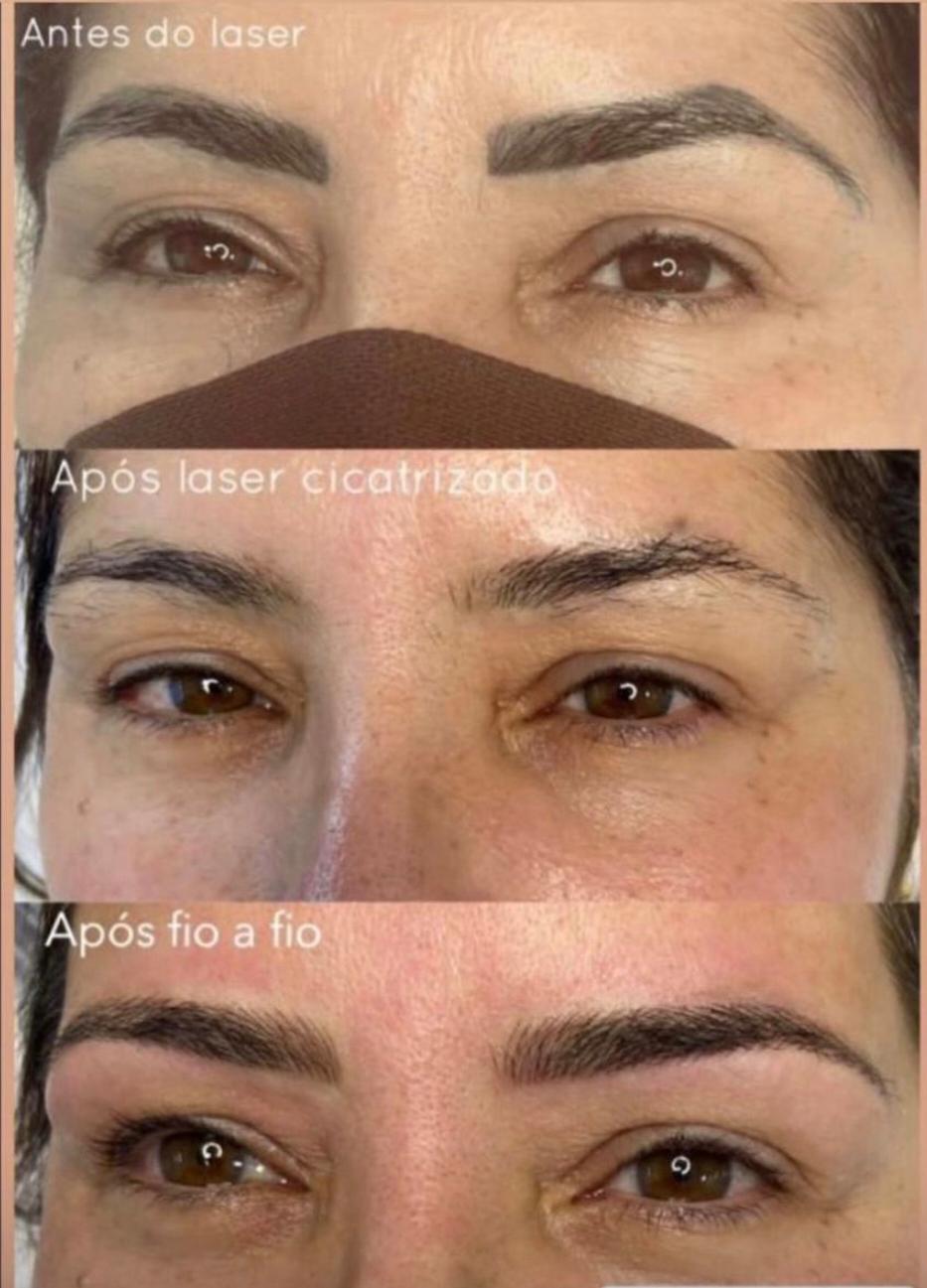 Protocolo R3 - antes e depois